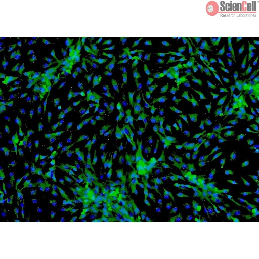 Sciencell Human Primary Cardiac Myocytes Cells - Image 2