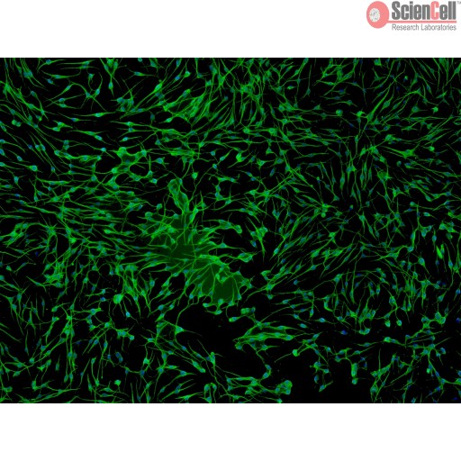 Sciencell Human Primary Melanocytes Cells - Image 3