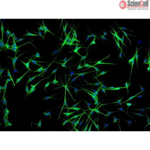 Sciencell Human Primary Melanocytes Cells - Image 2