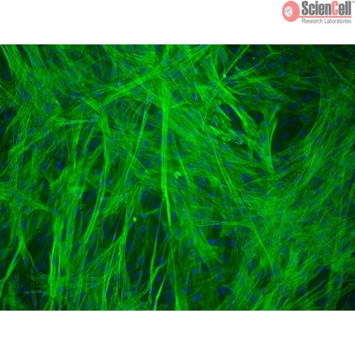 Sciencell Human Primary Smooth Muscle Cells - Image 4