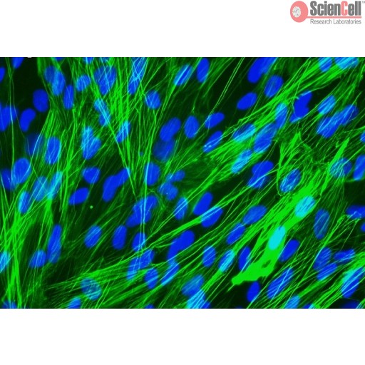Sciencell Human Primary Smooth Muscle Cells